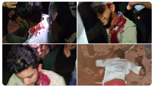 Dakshina Kannada 10 severely injured as cops lathi-charge on PFI protesters; security beefed up